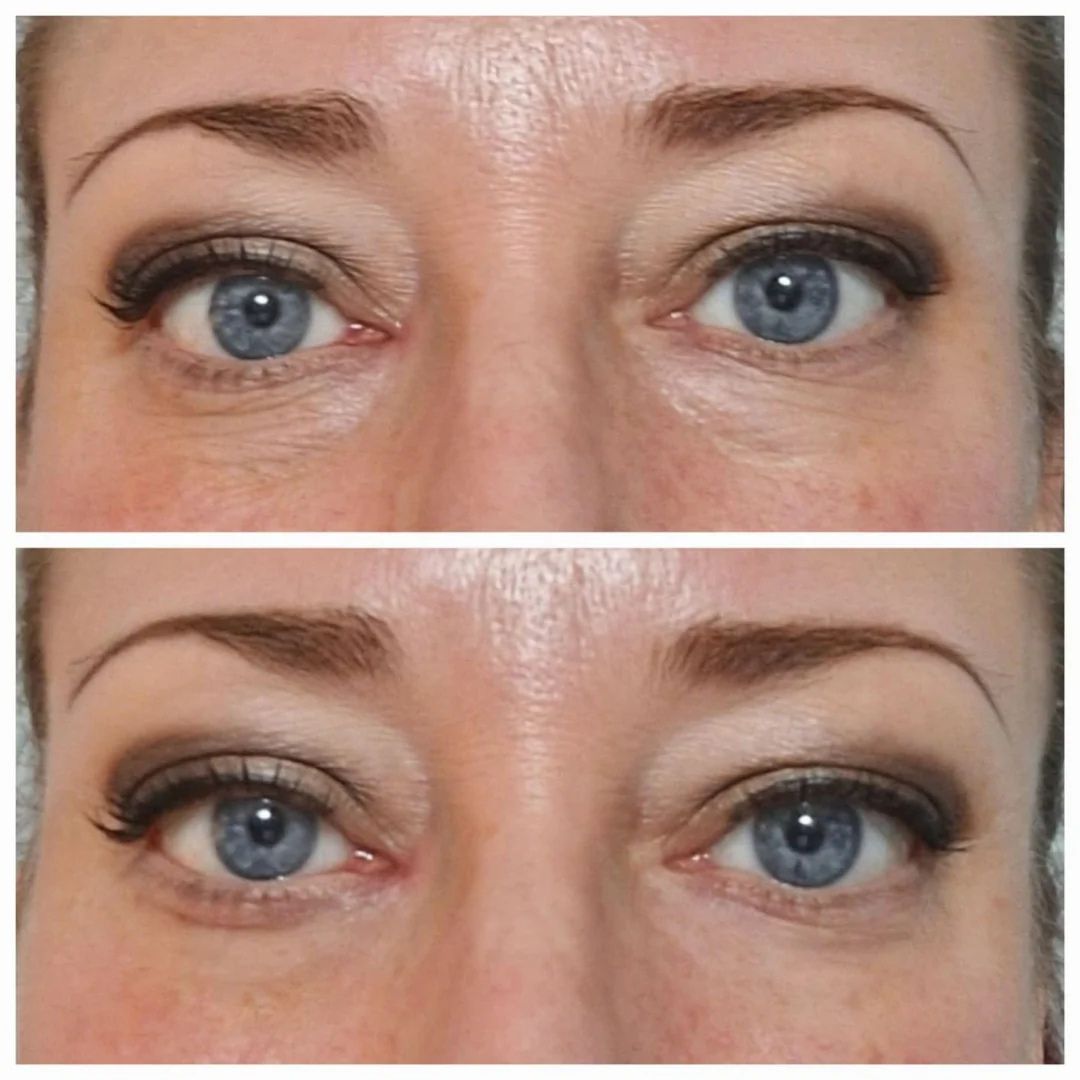 DermaLift™ – Lifting Instantané et Regard Illuminé