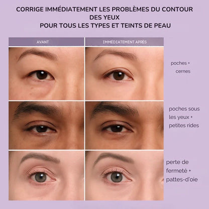 DermaLift™ – Lifting Instantané et Regard Illuminé